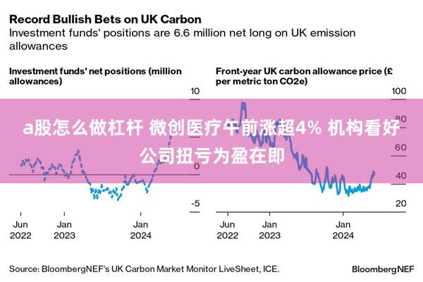 a股怎么做杠杆 微创医疗午前涨超4% 机构看好公司扭亏为盈在即